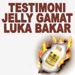 Testimoni Jelly Gamat Gold G Untuk Luka Bakar